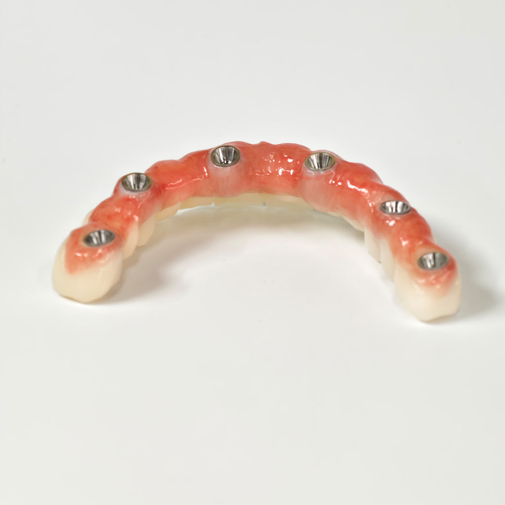 All On 6 Zirconia Bridge With Ti-Base Screw Retained