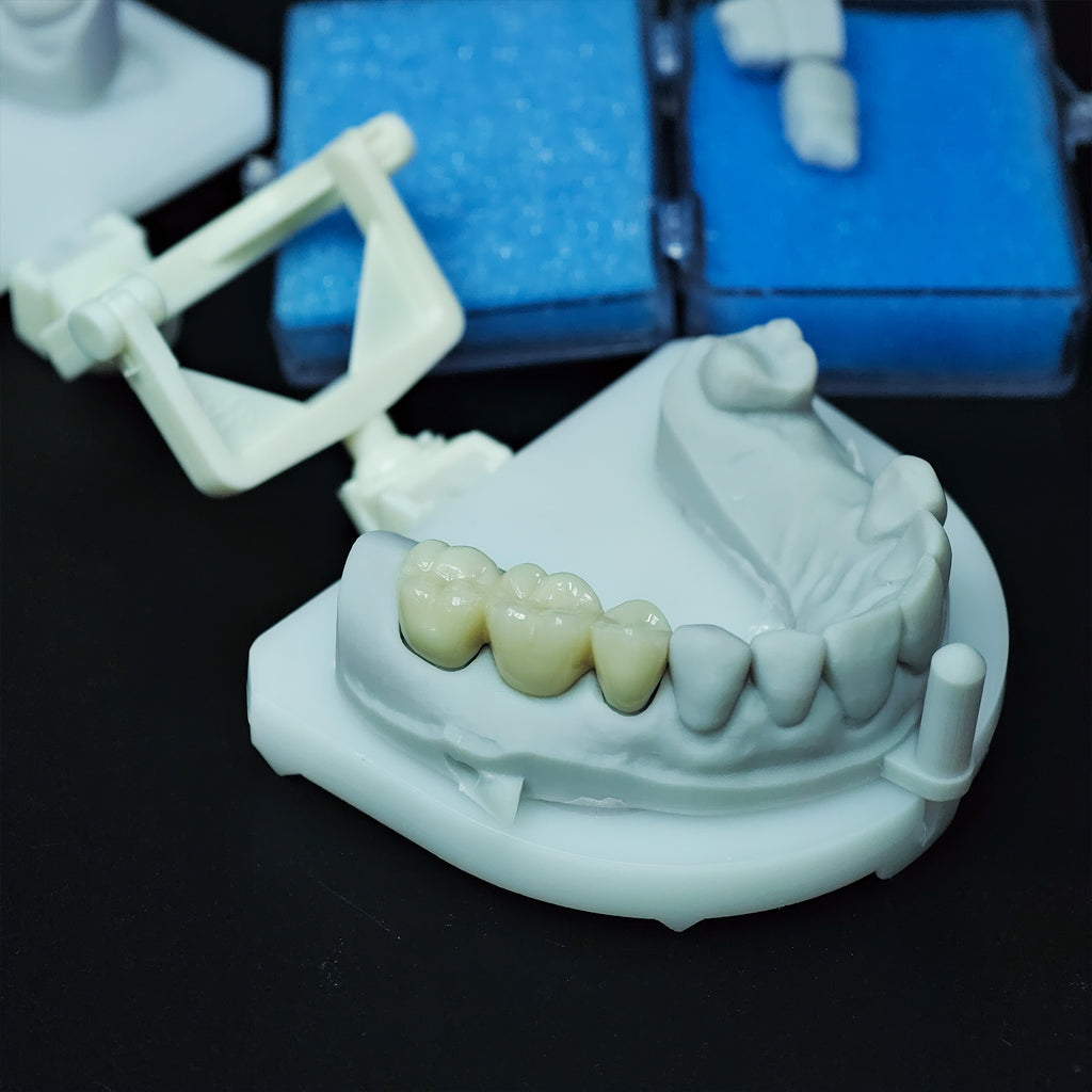 Beautiful Zirconia Bridge