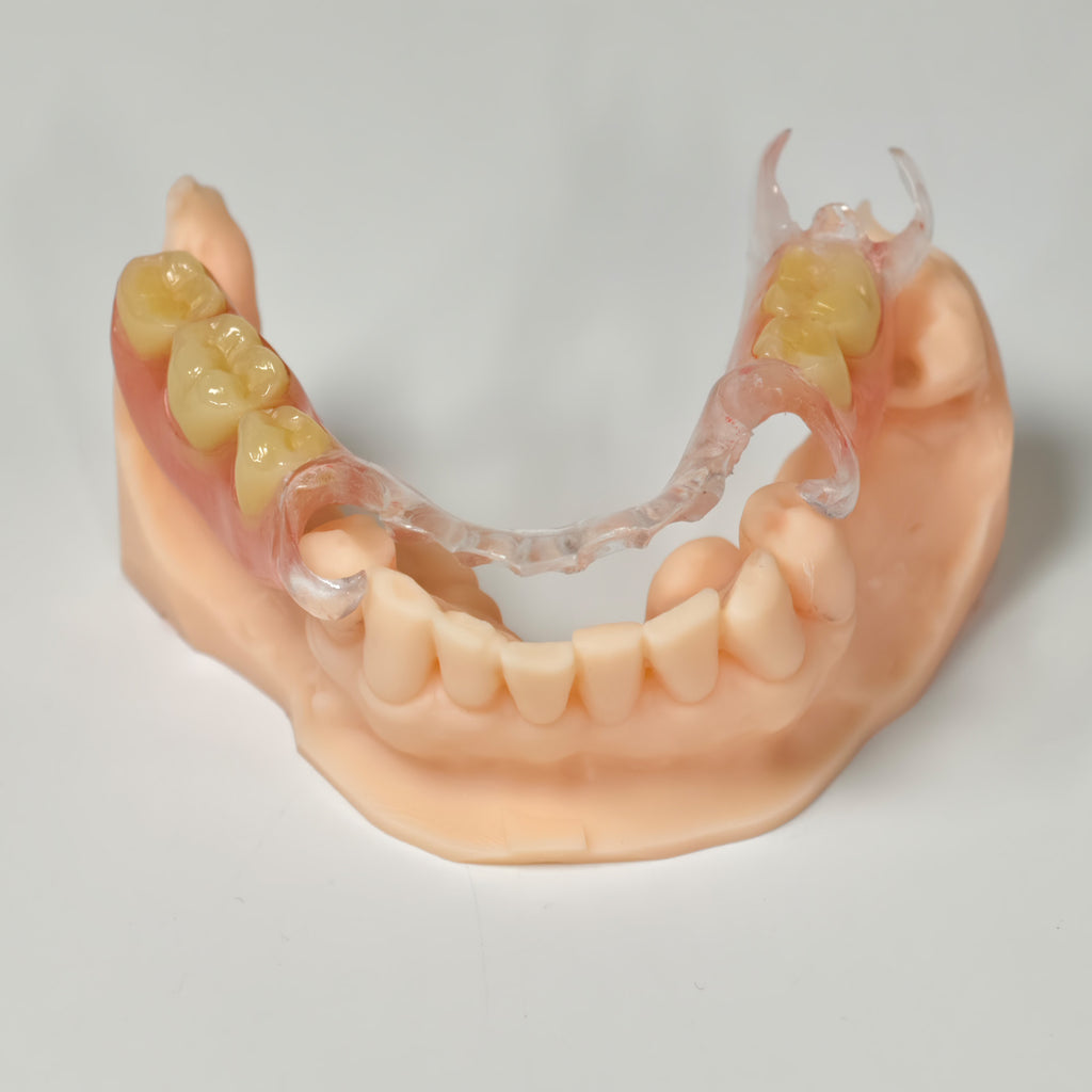 Clear Framework With Acrylic Denture Aesthetic Denture