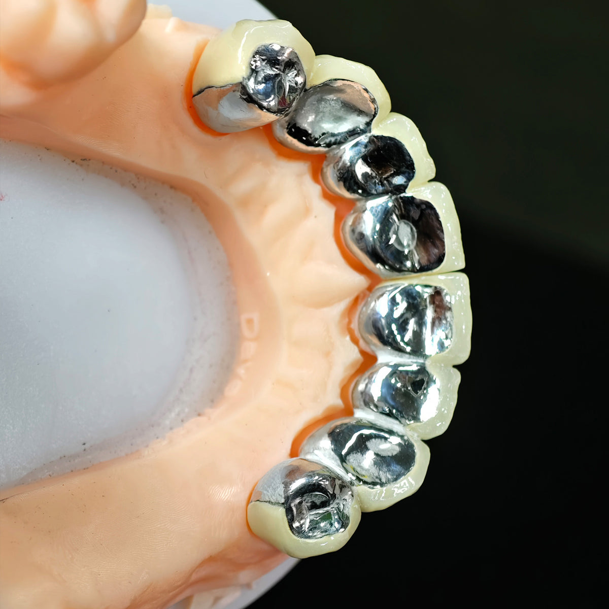 Co - Cr PFM Dental Bridge