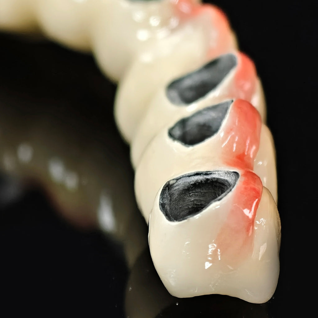 Co - Cr PFM Dental Bridge