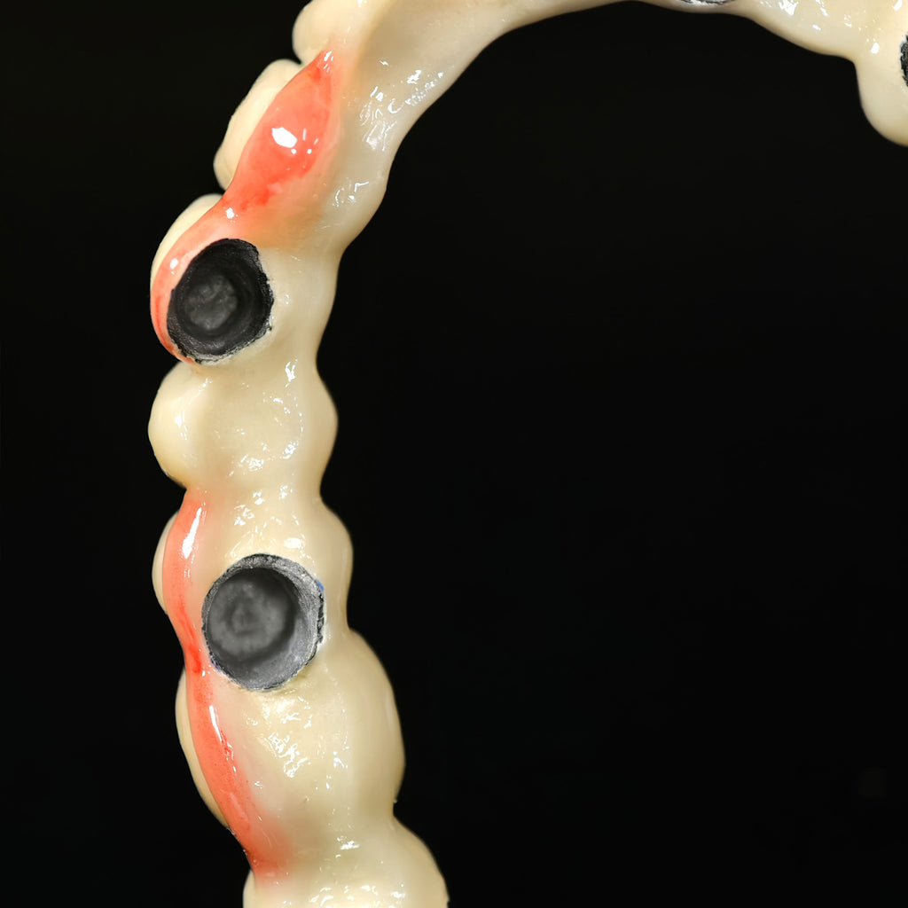 Co - Cr PFM Dental Bridge