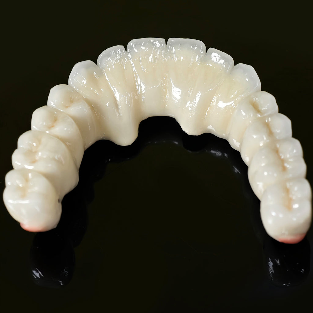 Co - Cr PFM Dental Bridge