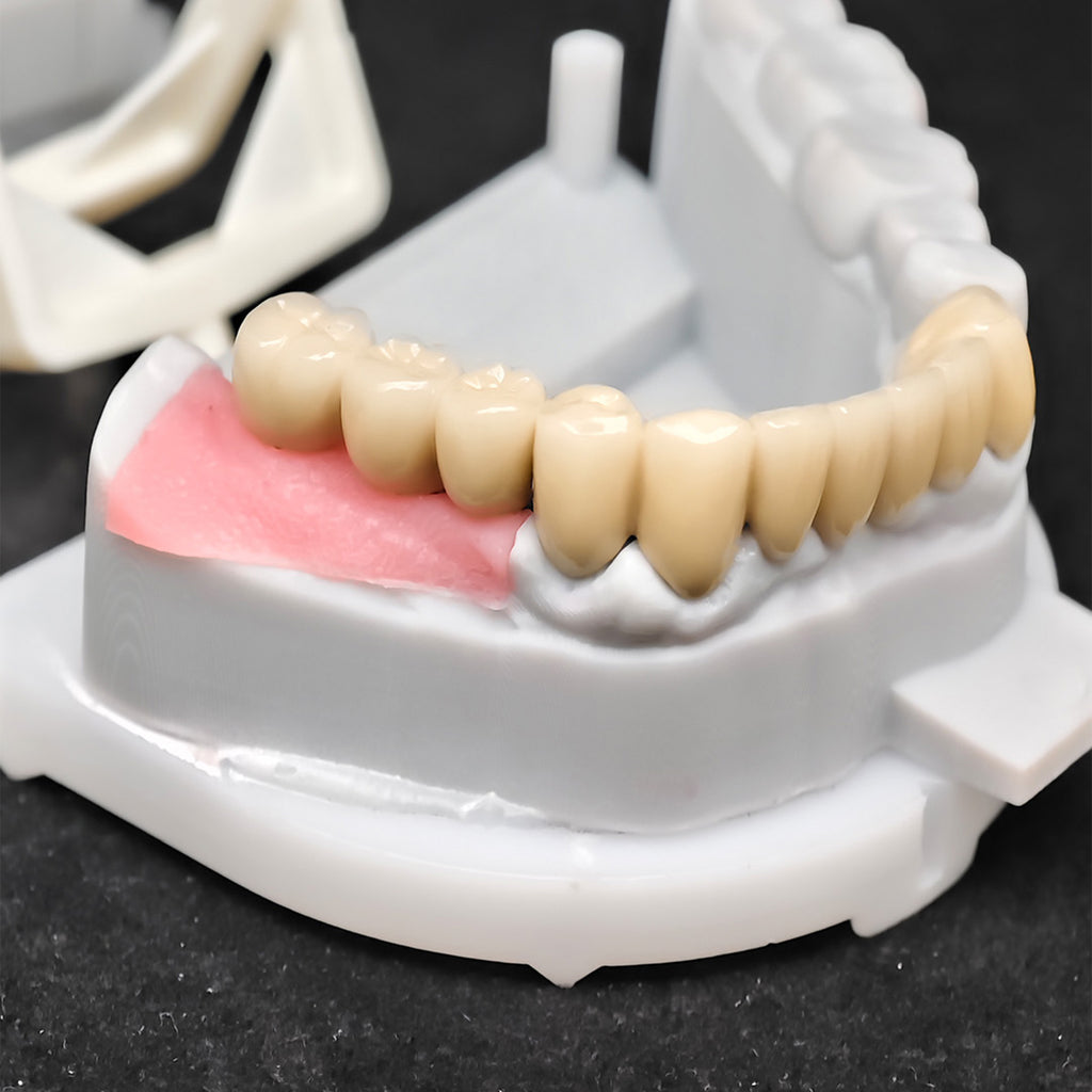 Co - Cr PFM Dental Bridge