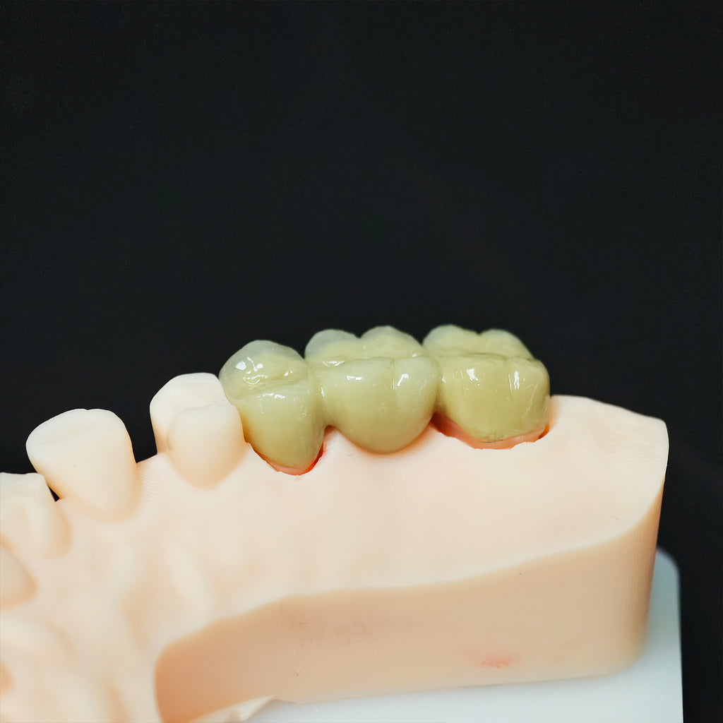 Co - Cr Pfm Dental Crowns And Bridge