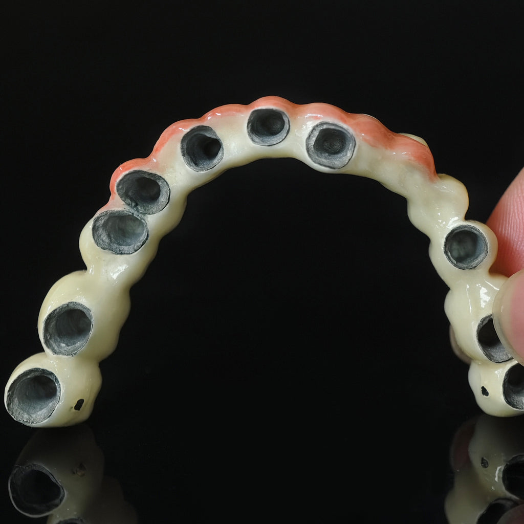 Co - Cr PFM Dental Bridge