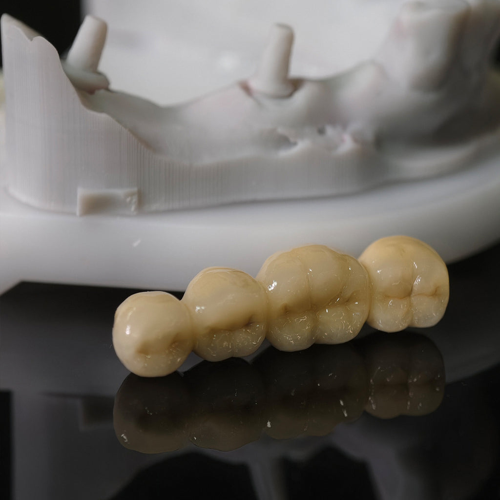 Co - Cr PFM Dental Bridge