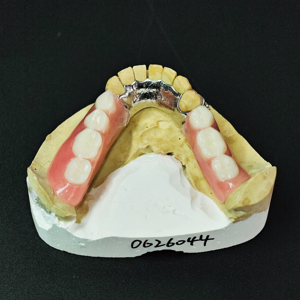 Cobalt Chrome Framework Denture Metal Framework With Acrylic Denture