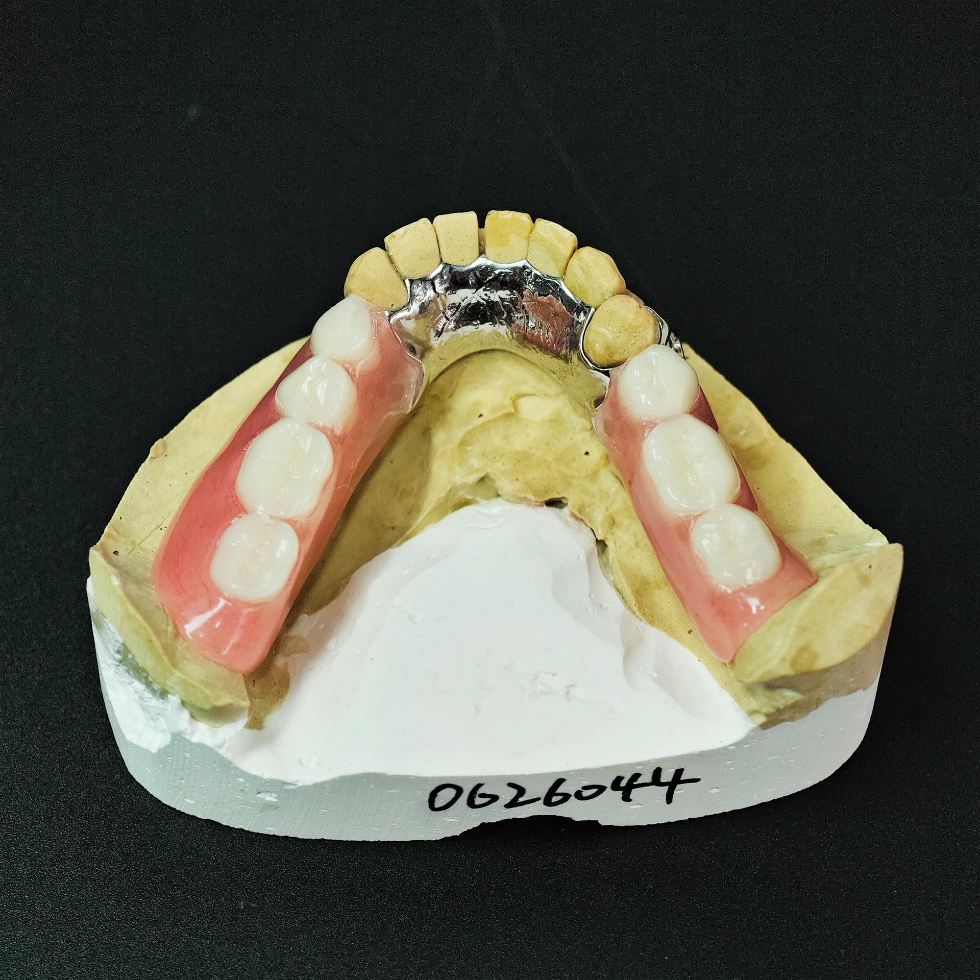 Cobalt Chrome Framework Denture Metal Framework With Acrylic Denture