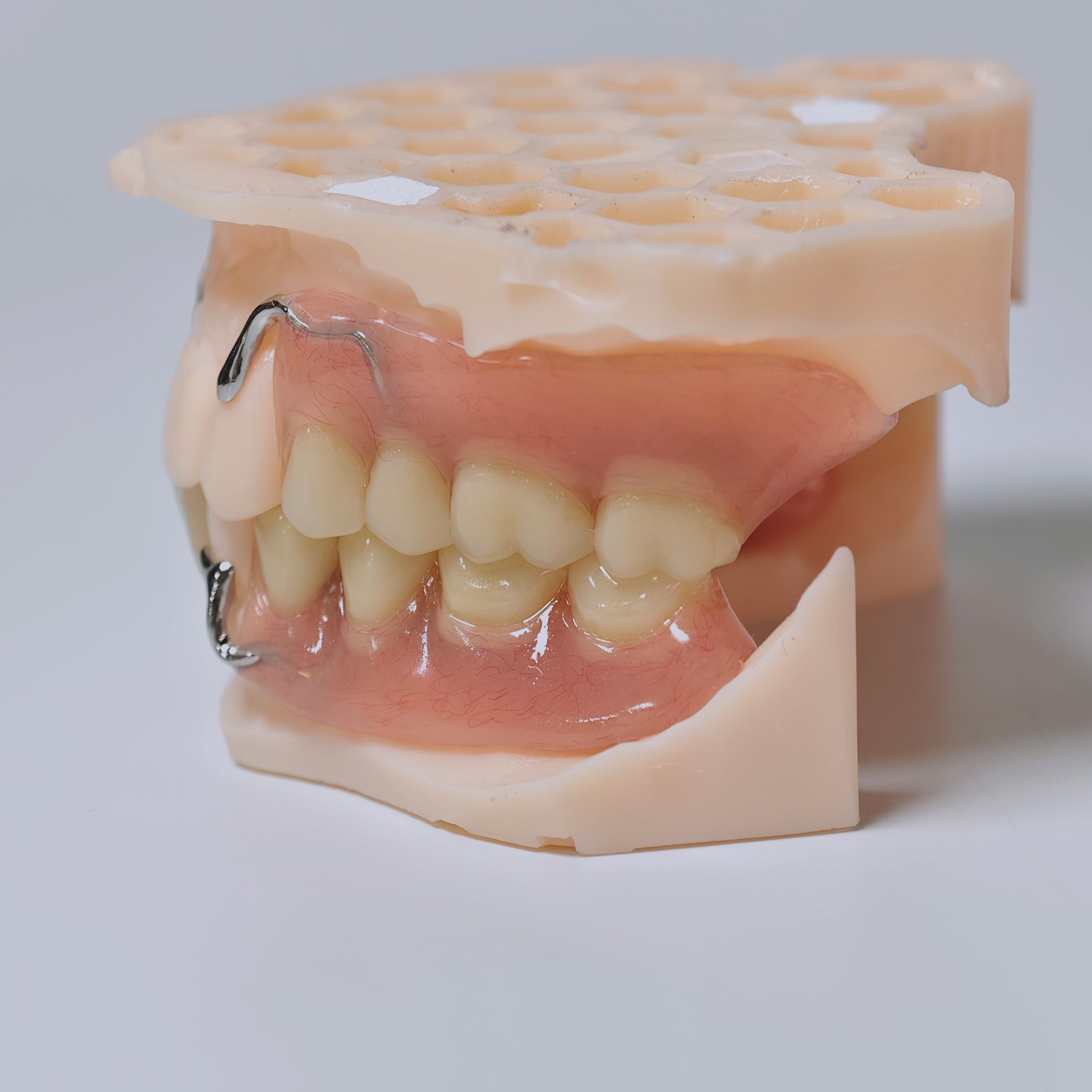 Cobalt Chrome Framework Denture Metal Framework With Acrylic Denture