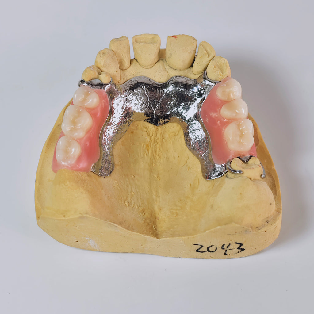 Cobalt Chrome Framework Denture Metal Framework With Acrylic Denture