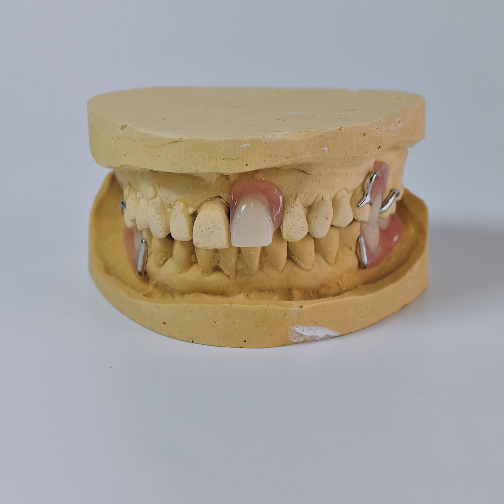Cobalt Chrome Framework Denture Metal Framework With Acrylic Denture