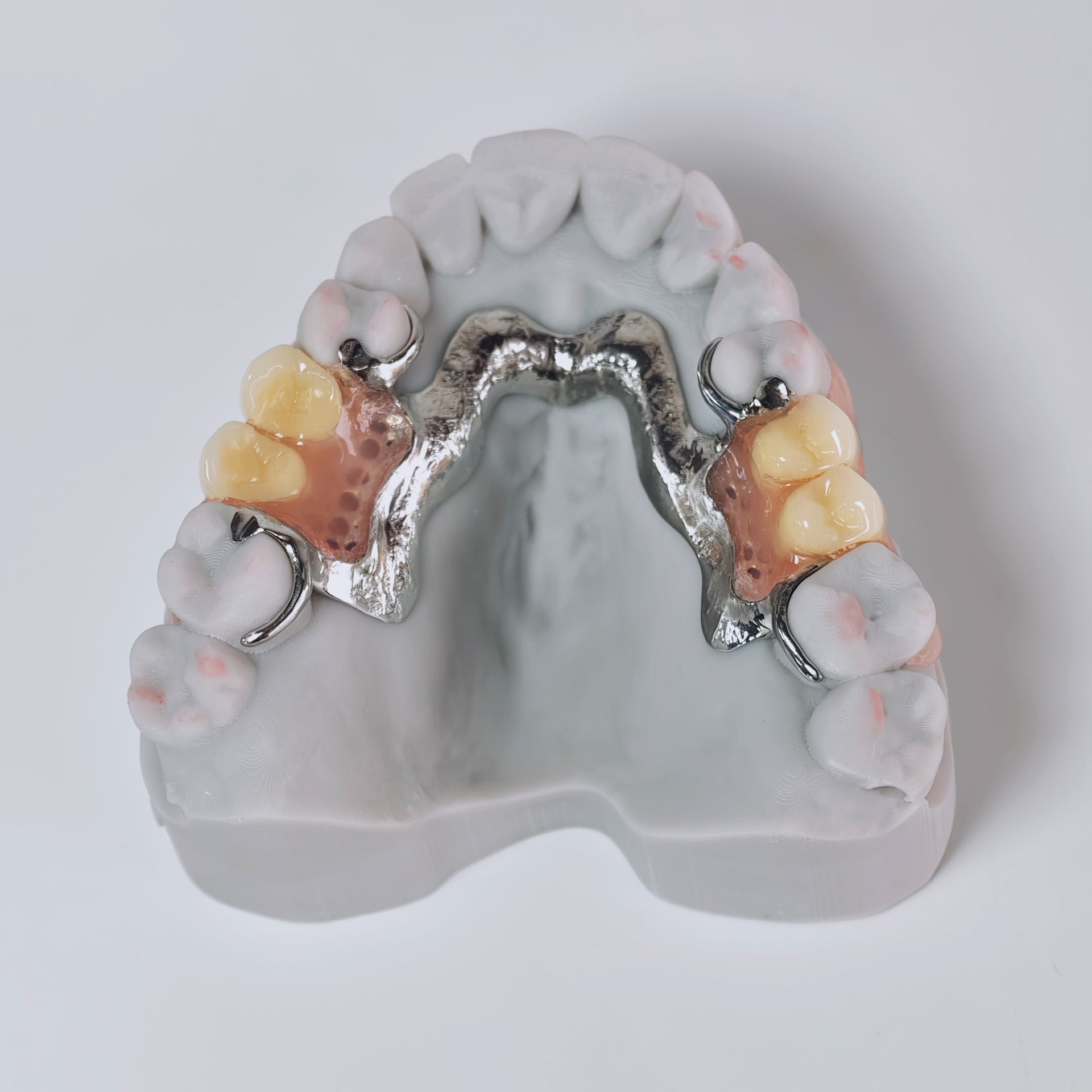 Cobalt Chrome Framework Denture Metal Framework With Acrylic Denture
