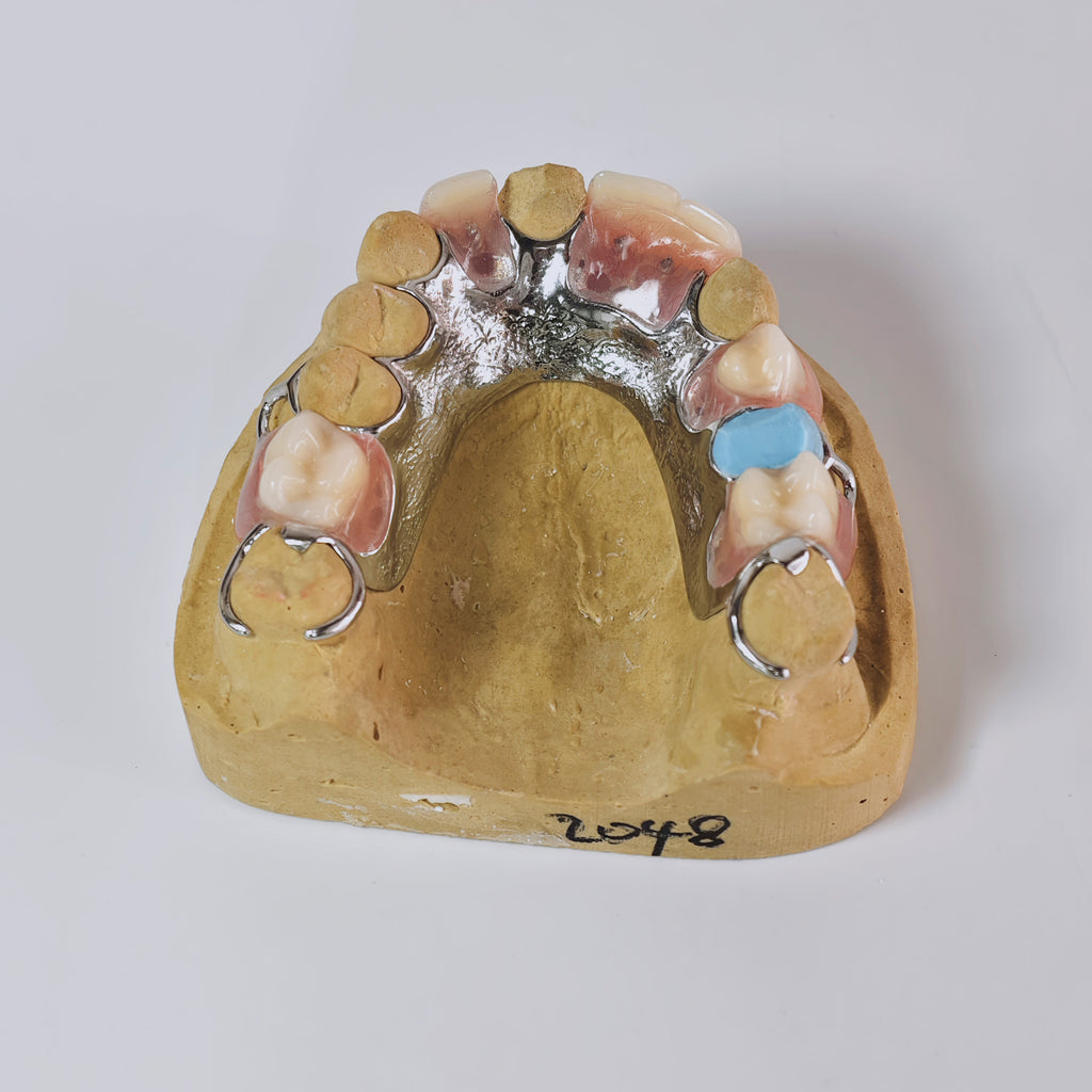 Cobalt Chrome Framework Denture Metal Framework With Acrylic Denture
