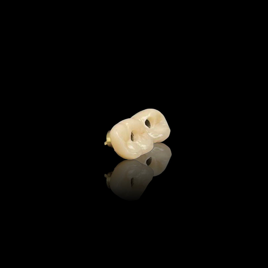 Custom Zirconia Implant Bridge
