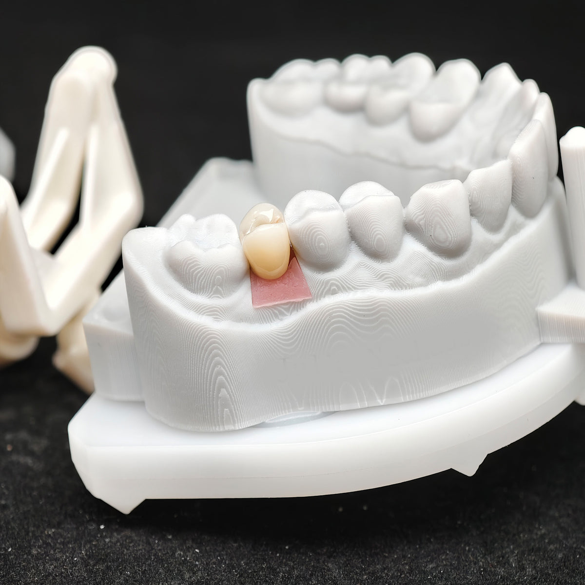 Custom Zirconia Implant Crowns