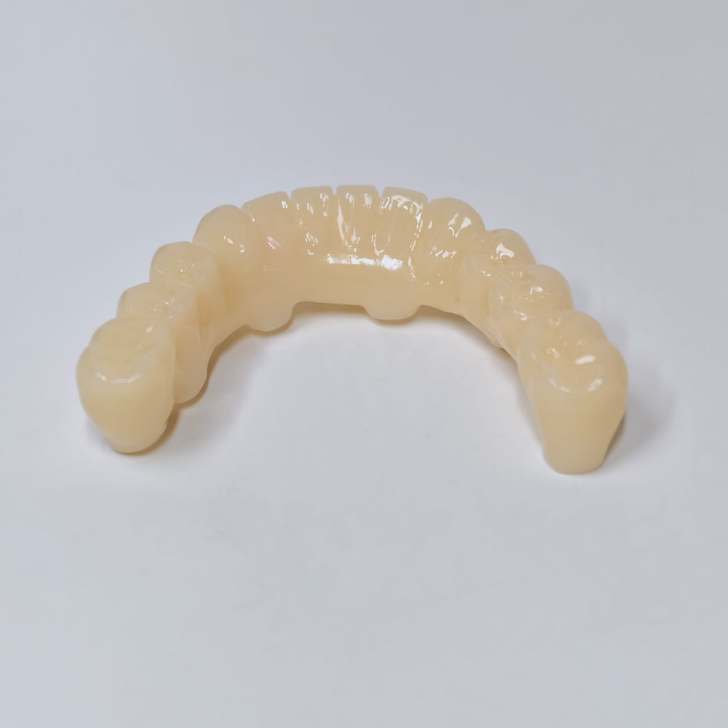 Custom Abutment And PMMA Bridge With Cement Retained And Implant Seating Guide
