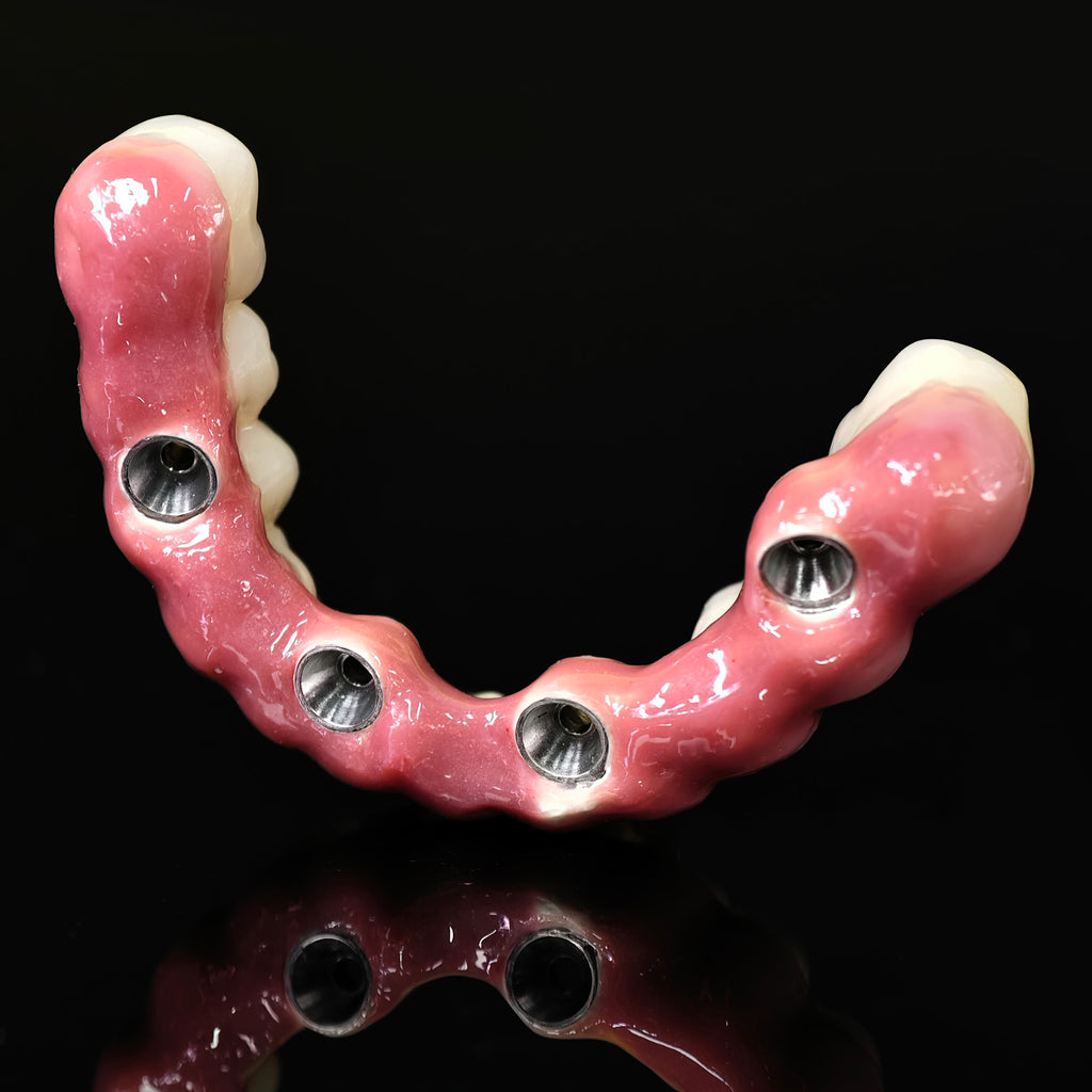 Enhanced Zirconia Crown Malo Bridge
