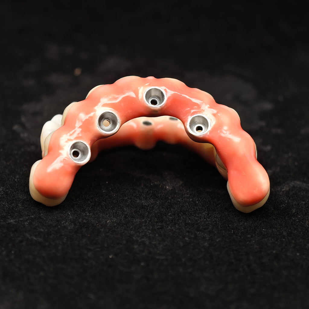 Enhanced Zirconia Crown Malo Bridge