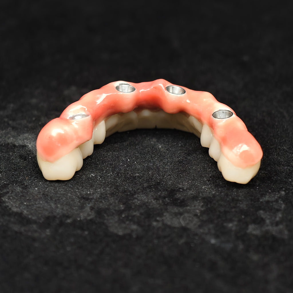 Enhanced Zirconia Crown Malo Bridge