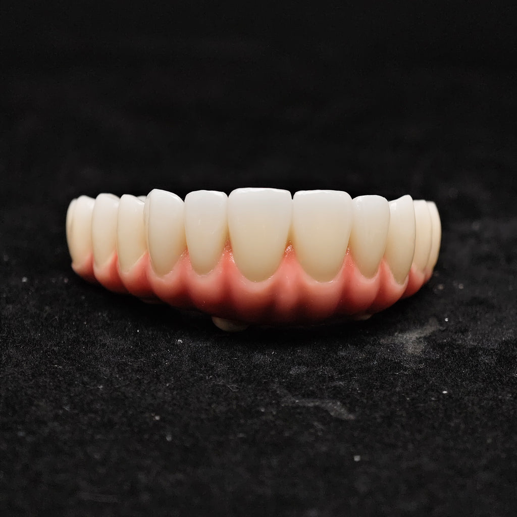Enhanced Zirconia Crown Malo Bridge