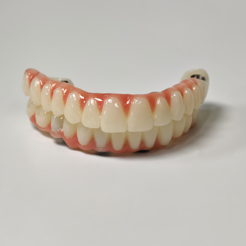 Full-Arch PMMA Bridge With Ti-Base Screw Retained