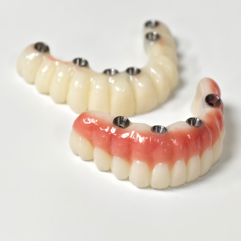 Full-Arch PMMA Bridge With Ti-Base Screw Retained