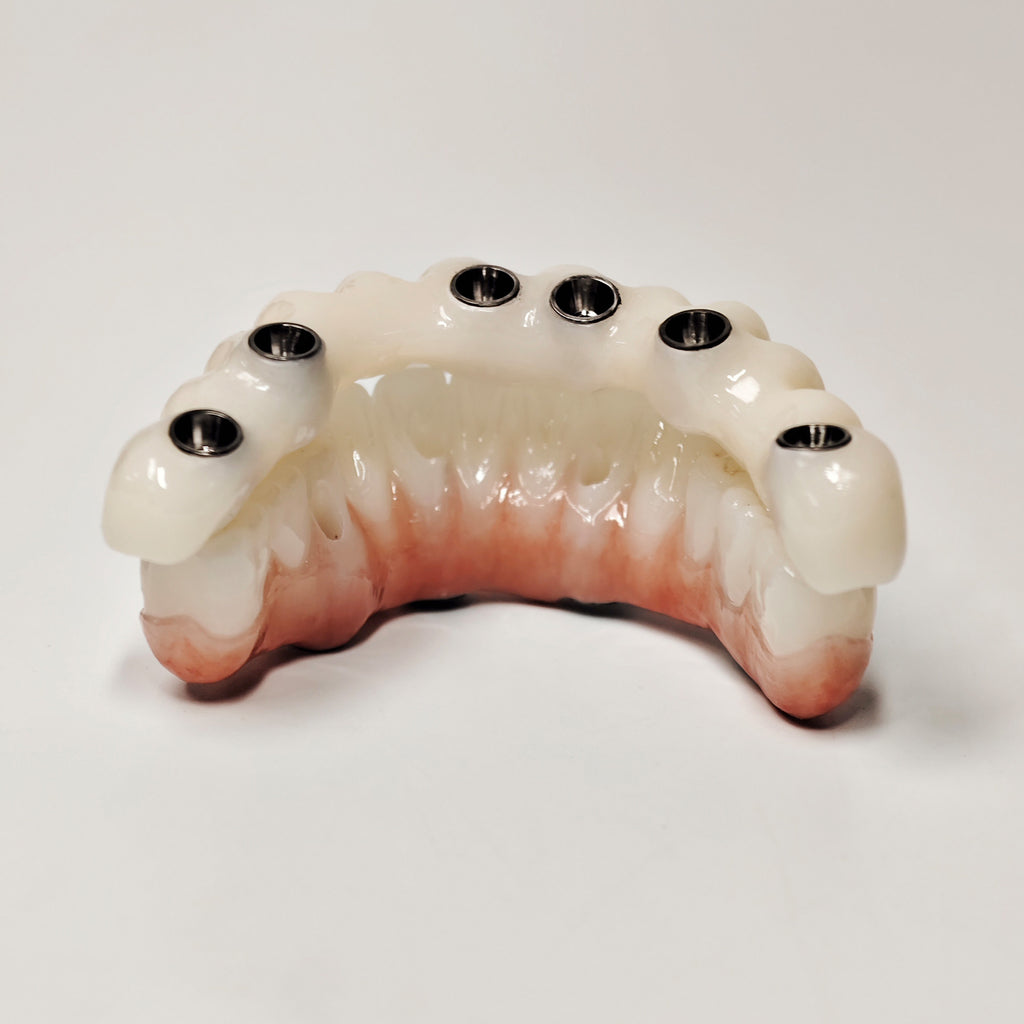 Full-Arch Zirconia Bridge With Ti-Base Abutment