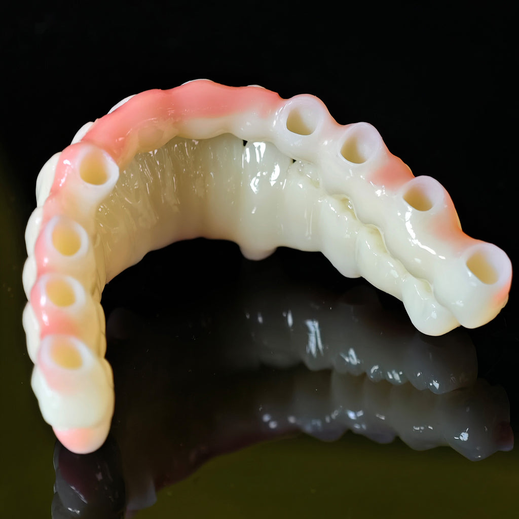 Full=Arch Pmma Bridge With Cement Retained