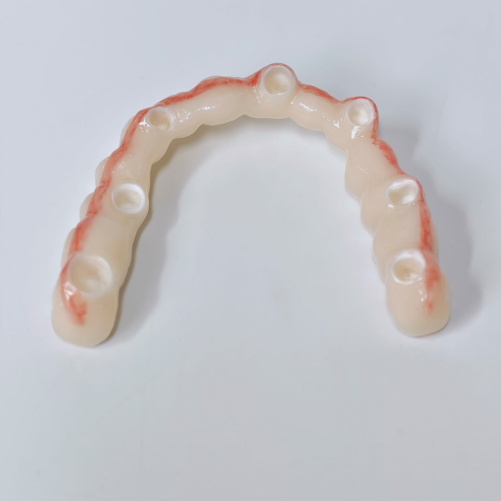 Half-Mouth Zirconia Bridge With Cement-Retained