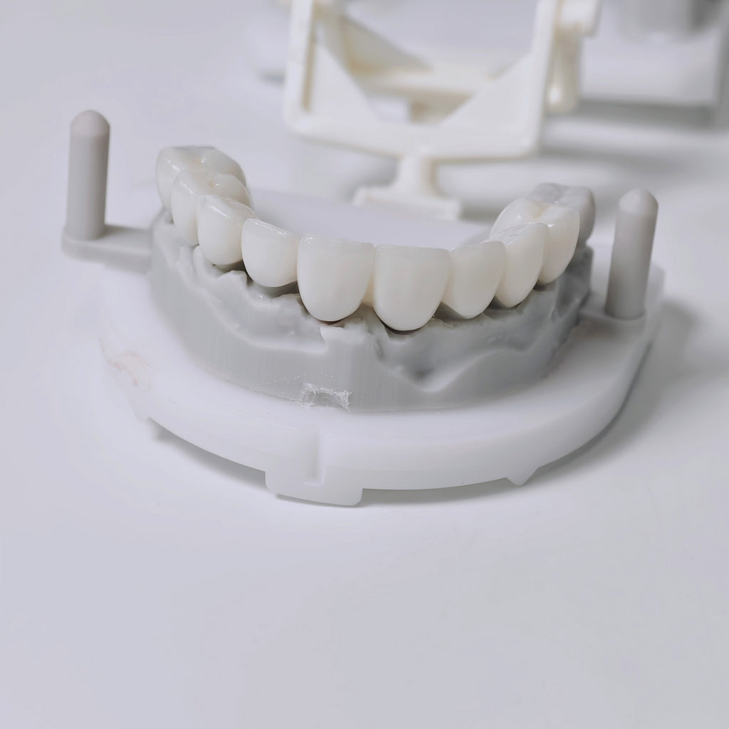 High - Strength Zirconia Bridge Aesthetic