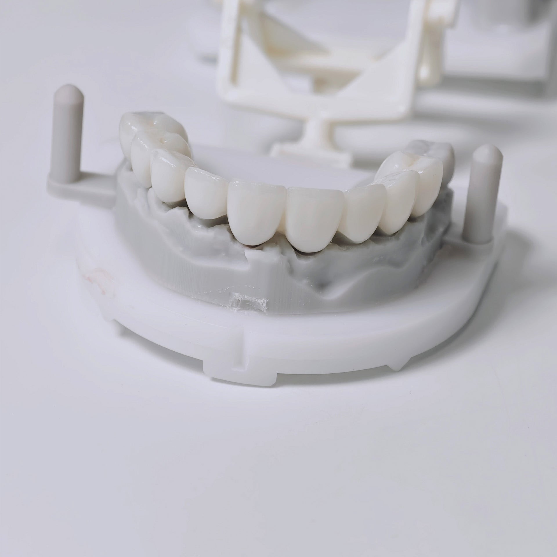 High - Strength Zirconia Bridge Aesthetic