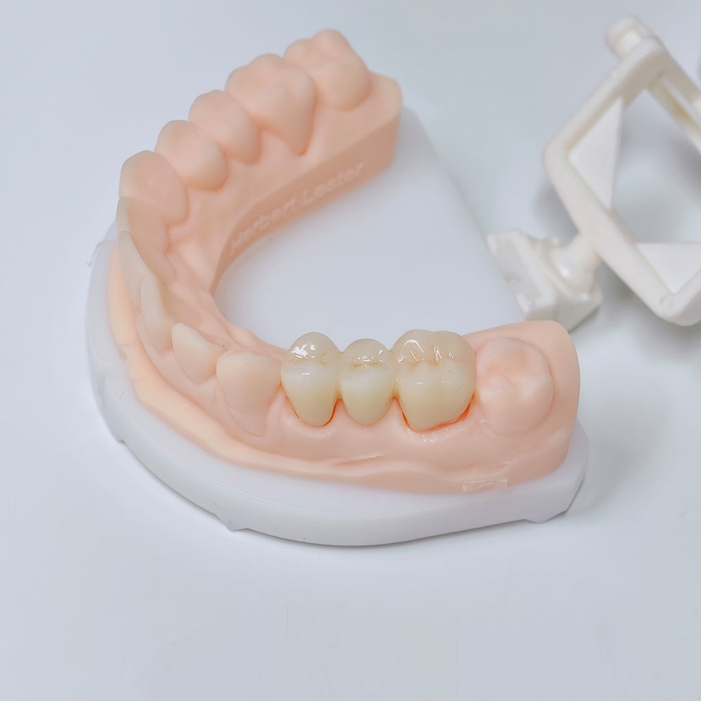 High - Strength Zirconia Bridge