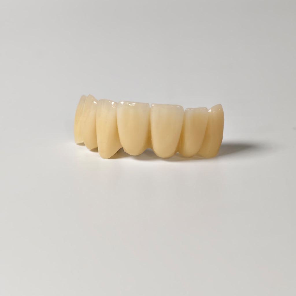 High - Strength Zirconia Bridge