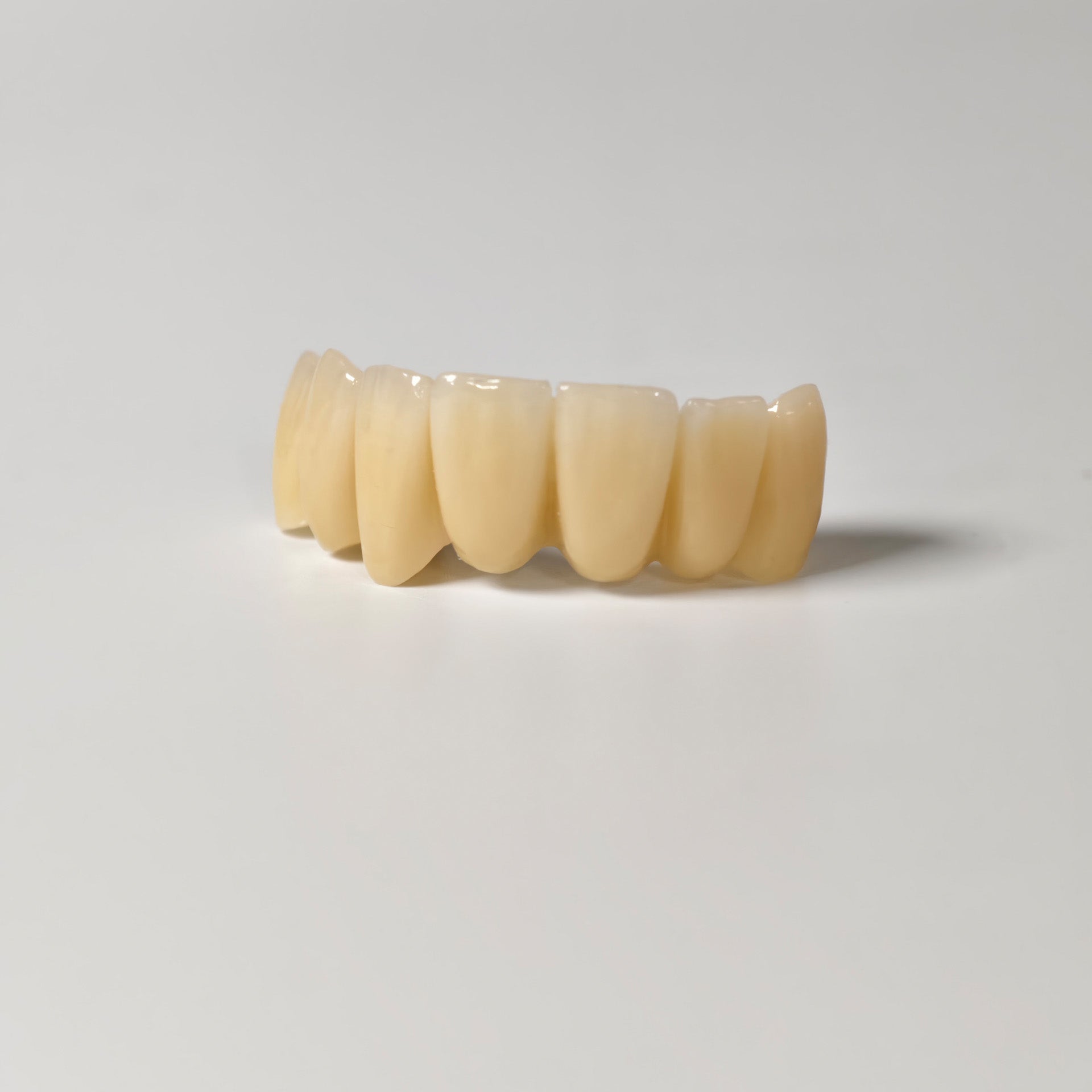 High - Strength Zirconia Bridge