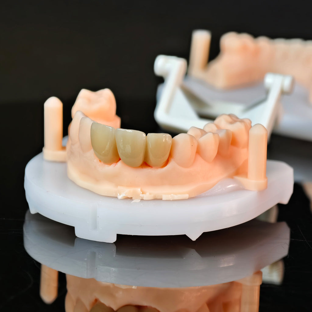 High - Strength Zirconia Bridge