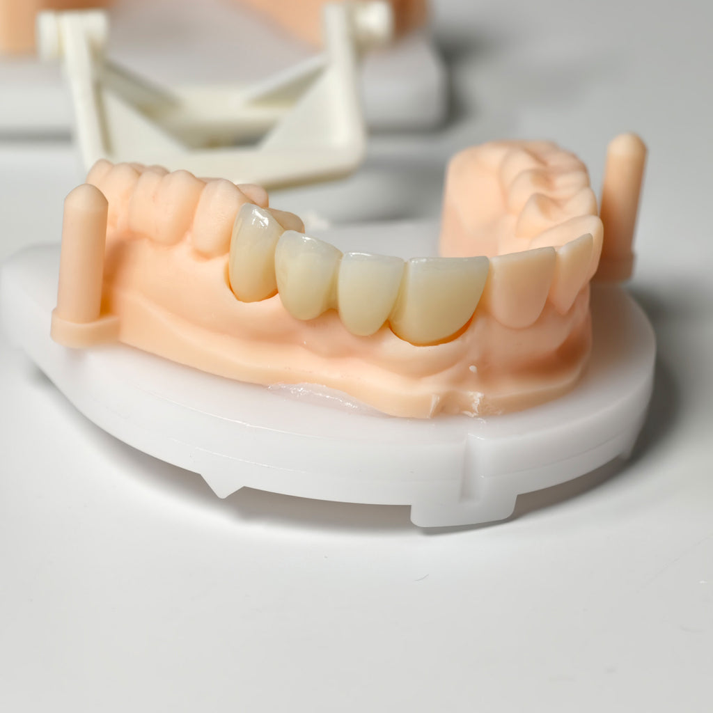 High - Strength Zirconia Bridge