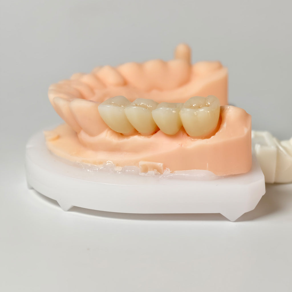 High - Strength Zirconia Bridge