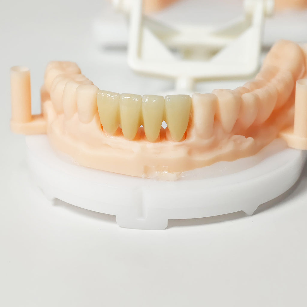 High - Strength Zirconia Bridge