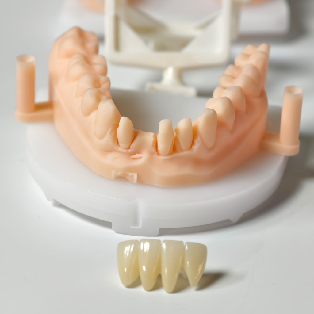 High - Strength Zirconia Bridge