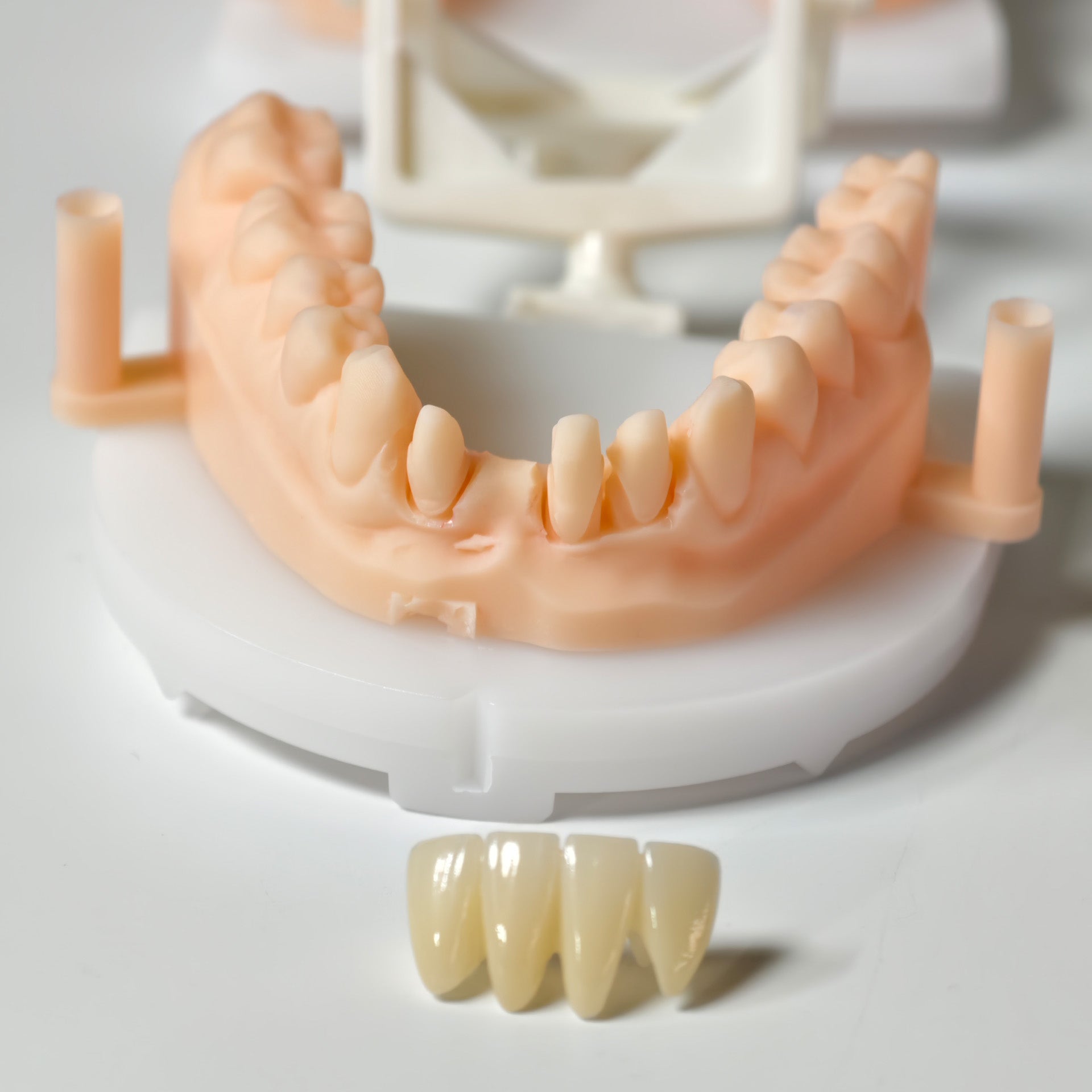 High - Strength Zirconia Bridge