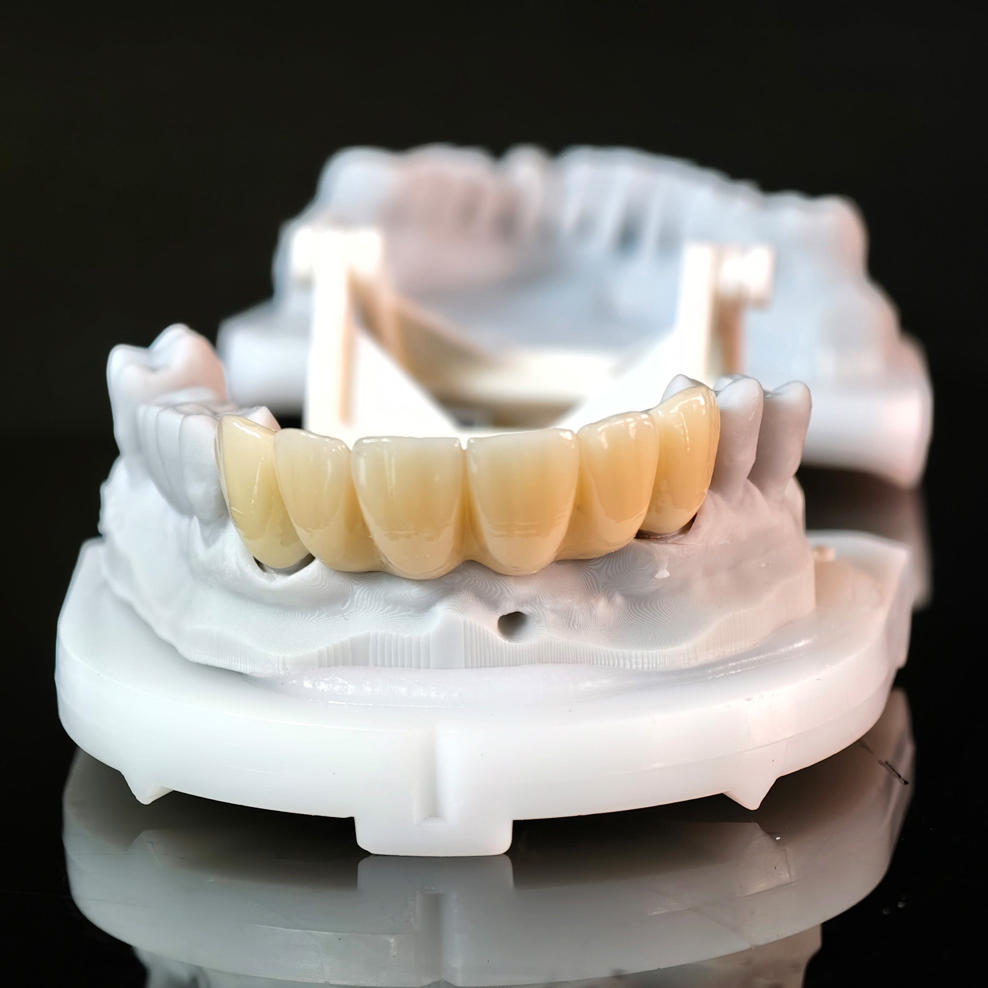 High - Strength Zirconia Bridge