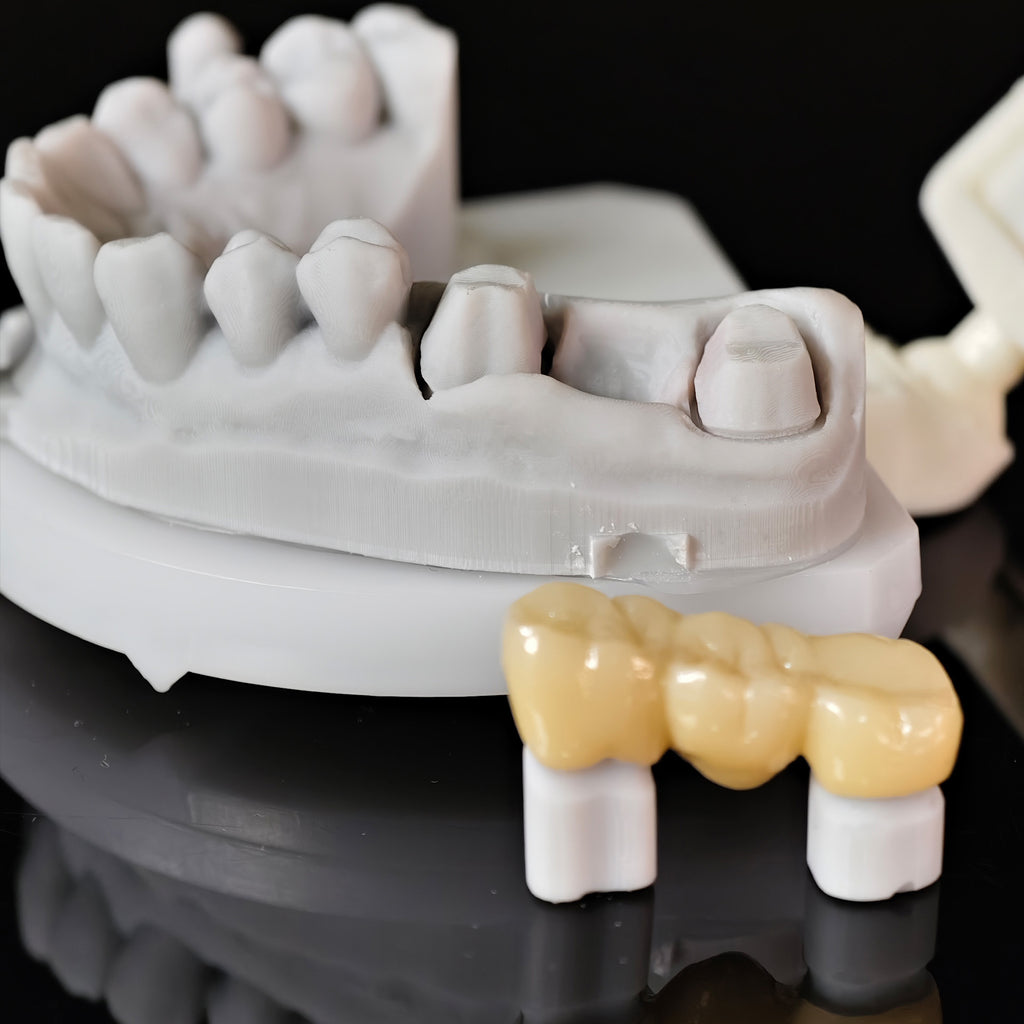 High - Strength Zirconia Bridge