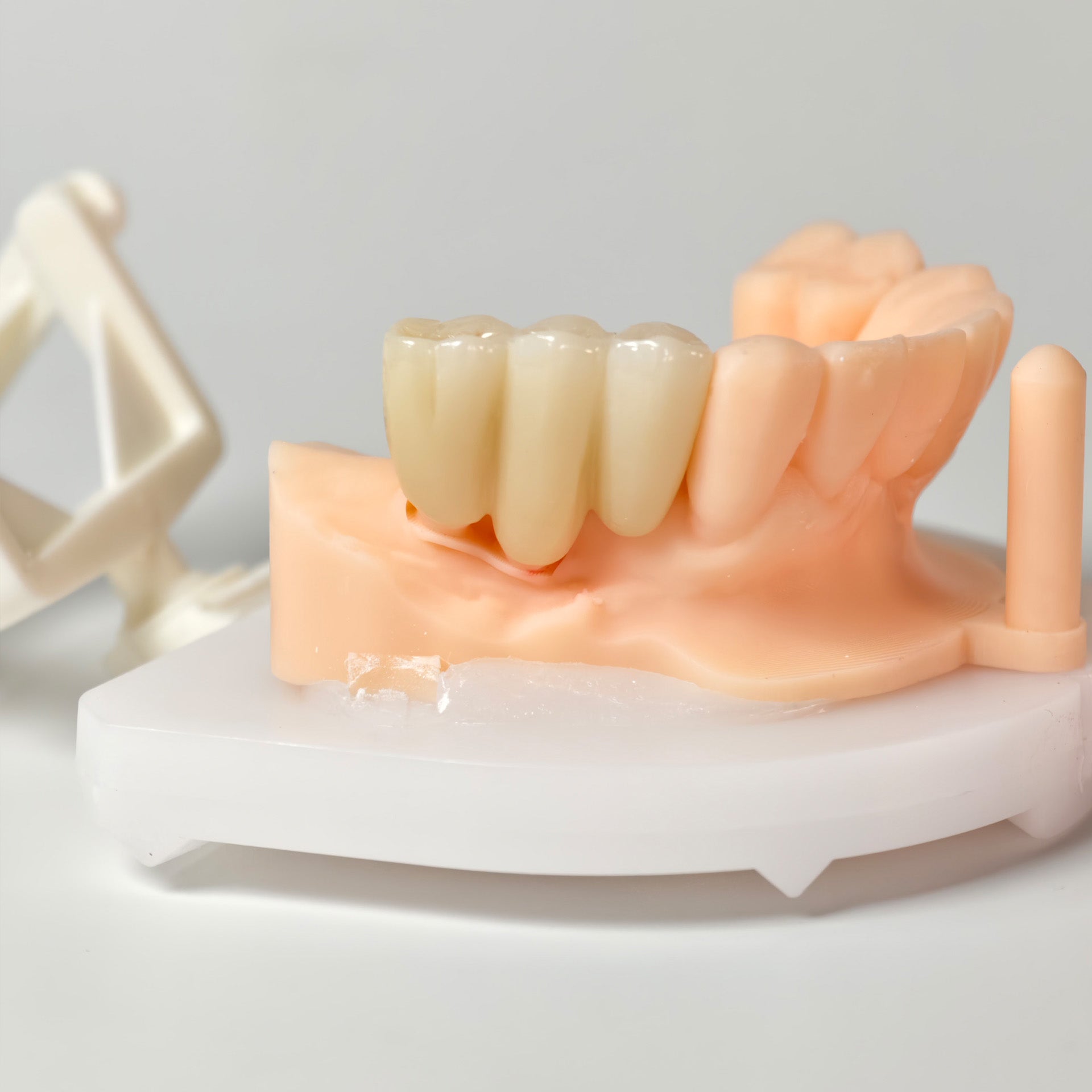 High - Strength Zirconia Bridge