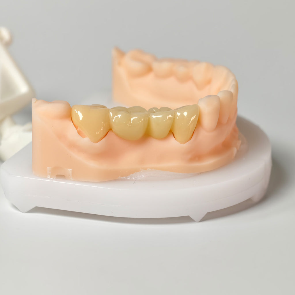 High - Strength Zirconia Bridge