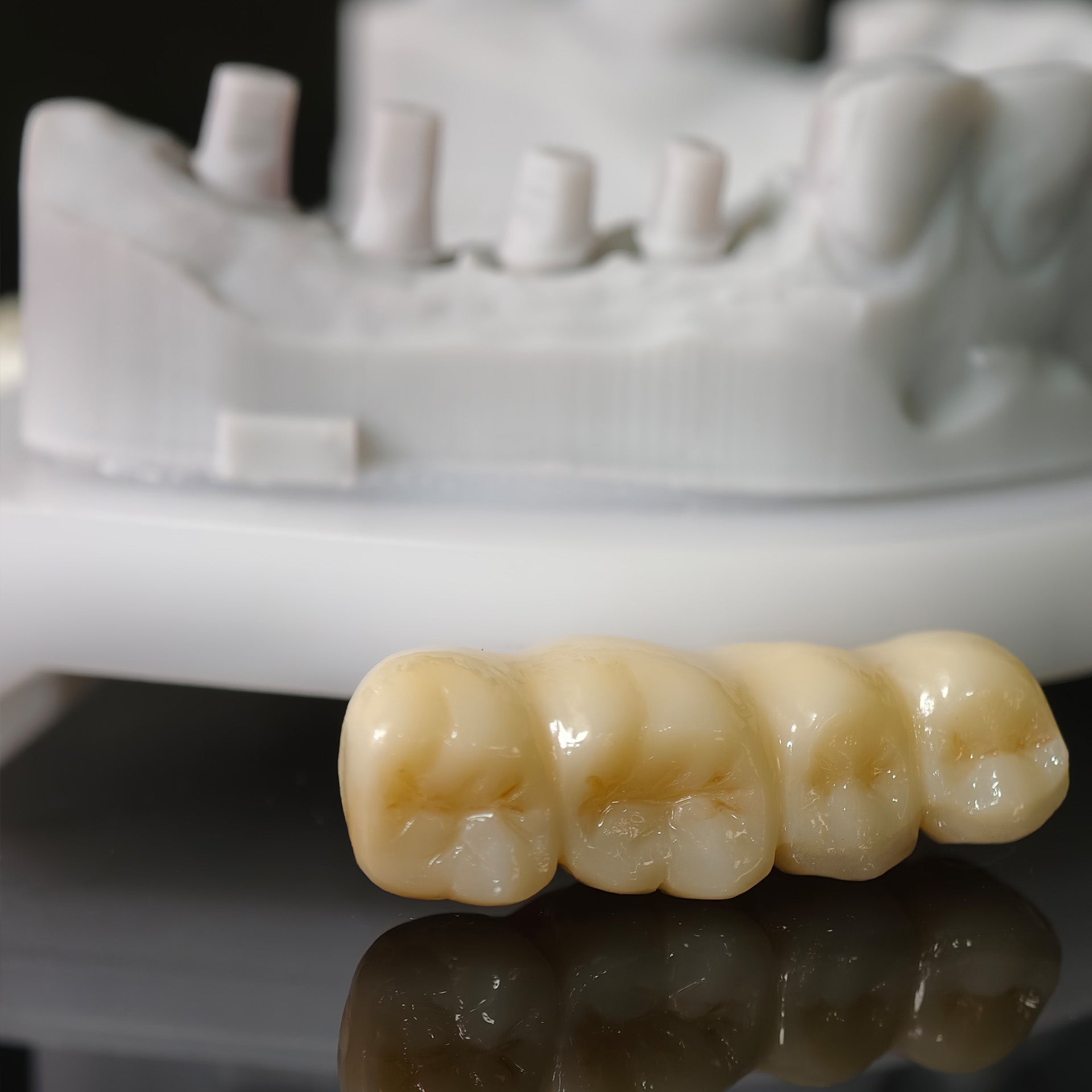 High - Strength Zirconia Bridge