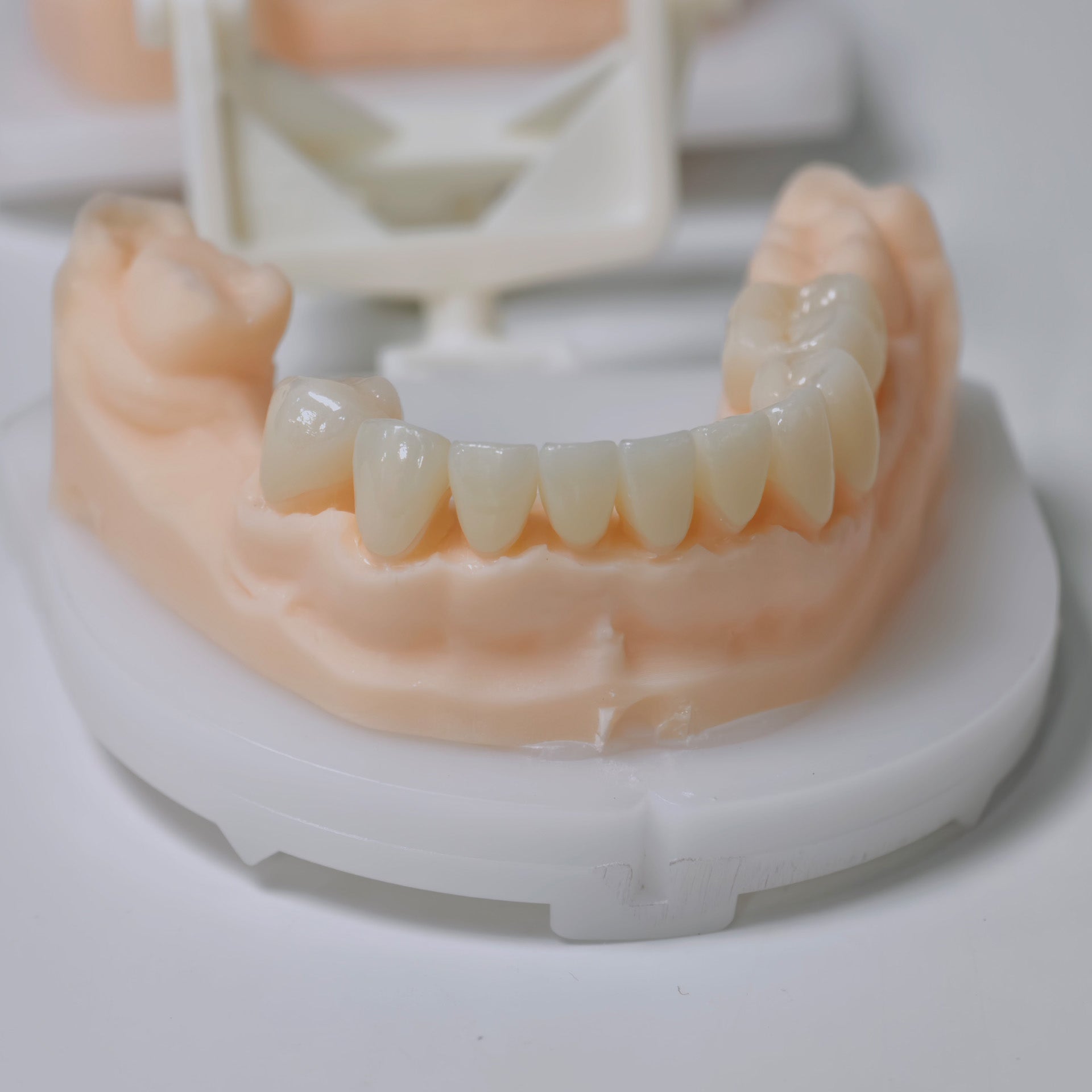High - Strength Zirconia Bridge And Crown