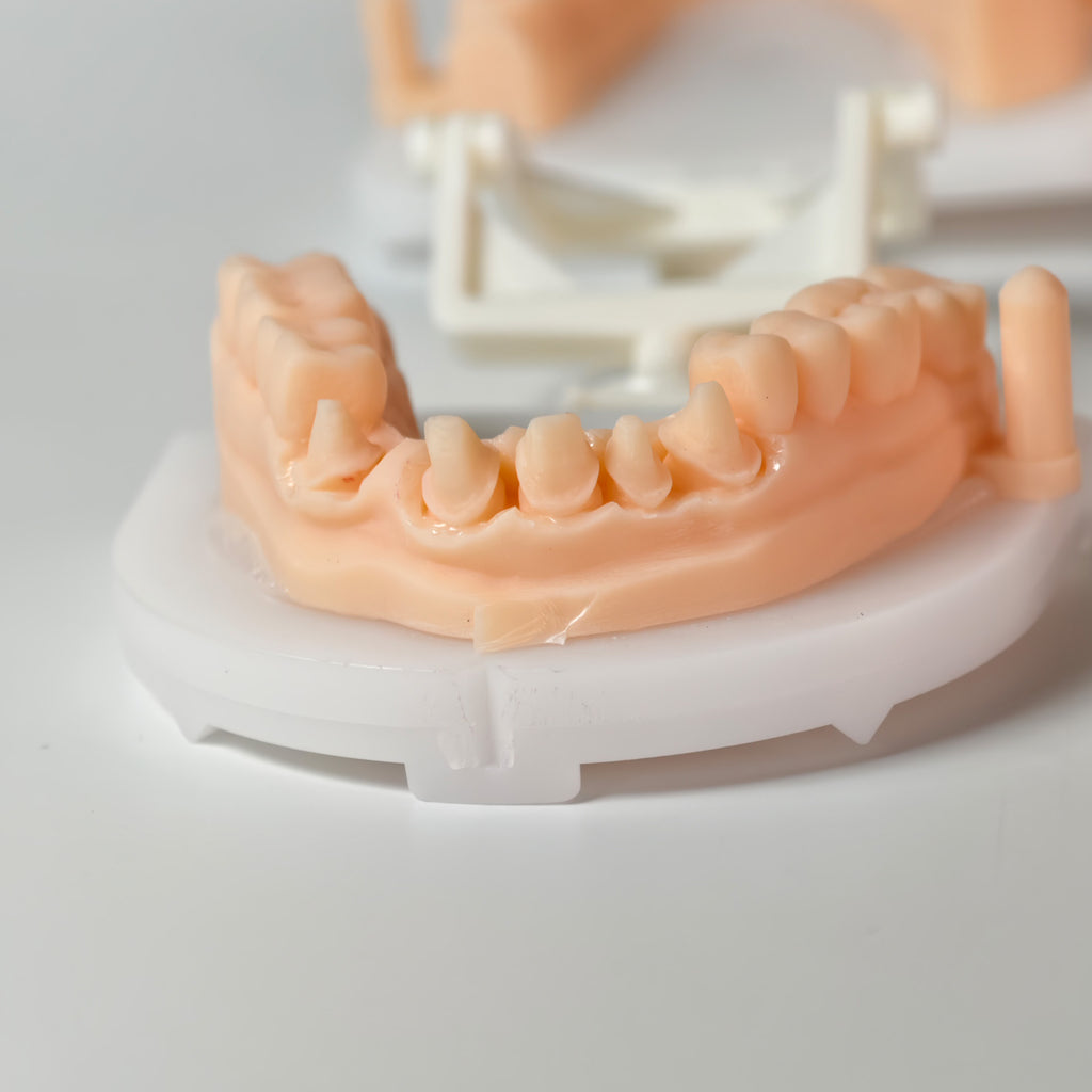 High - Strength Zirconia Bridge And Crown
