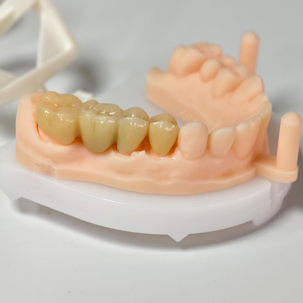 High - Strength Zirconia Bridge And Crown