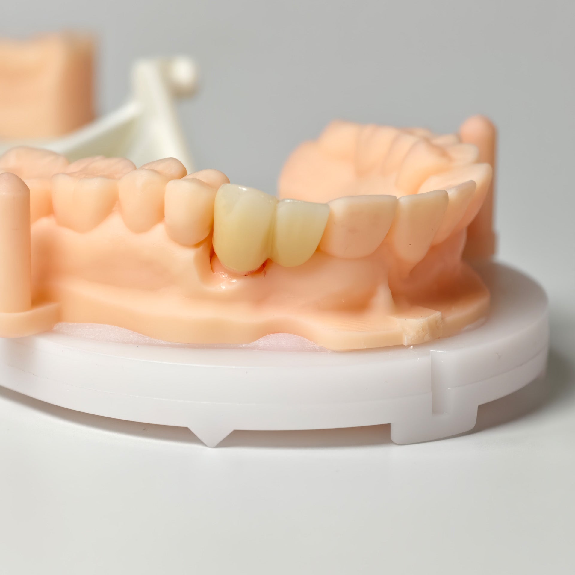 High - Strength Zirconia Crown